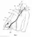 Fig. 02 - Delivery system for an embolic protection device
