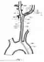 Fig. 09 - Delivery system for an embolic protection device