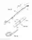 Fig. 16 - Surgical coils and methods of deploying