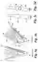 Fig. 06 - Apparatus for the correction of skeletal deformities