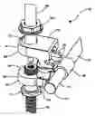 Fig. 01 - Spinal stabilization system for the stabilization and fixation of the lumbar spine and method for using same