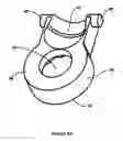 Fig. 06 - Spinal stabilization system for the stabilization and fixation of the lumbar spine and method for using same