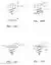 Fig. 14 - Methods of bone, joint, and ligament reconstruction