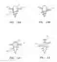 Fig. 18 - Methods of bone, joint, and ligament reconstruction