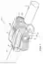 Fig. 06 - Dynamic spinal stabilization device