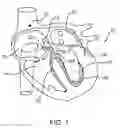Fig. 02 - CARDIAC PACEMAKERS AND SYSTEMS AND METHODS FOR USING THEM
