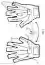 Fig. 06 - Raynaud's Conditions