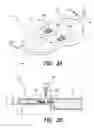 Fig. 04 - Fixation methods and systems for cochlear implant component or other implantable devices