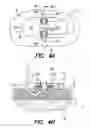 Fig. 07 - Fixation methods and systems for cochlear implant component or other implantable devices