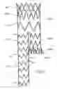 Fig. 06 - Flexible stent-graft