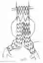 Fig. 08 - Flexible stent-graft