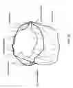 Fig. 04 - In-situ formation of a valve