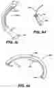 Fig. 06 - Devices and methods for heart valve treatment