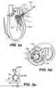 Fig. 09 - Devices and methods for heart valve treatment