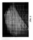 Fig. 07 - Orthotic device for preventing and/or correcting deformational posterior plagiocephaly