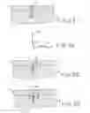 Fig. 07 - Articular cartilage fixation device and method