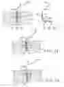 Fig. 09 - Articular cartilage fixation device and method