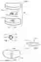 Fig. 02 - Prosthetic intervertebral discs assemblies having compressible core elements with enhanced torque transmission