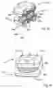 Fig. 09 - Prosthetic intervertebral discs assemblies having compressible core elements with enhanced torque transmission