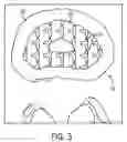 Fig. 04 - Engineered scaffolds for intervertebral disc repair and regeneration and for articulating joint repair and regeneration