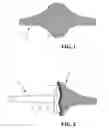Fig. 02 - Hydrogel proximal interphalangeal implant
