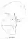 Fig. 02 - IMPLANT AND A METHOD FOR PARTIAL REPLACEMENT OF JOINT SURFACES