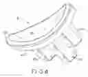 Fig. 06 - IMPLANT AND A METHOD FOR PARTIAL REPLACEMENT OF JOINT SURFACES