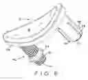 Fig. 08 - IMPLANT AND A METHOD FOR PARTIAL REPLACEMENT OF JOINT SURFACES
