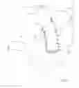 Fig. 06 - Method for treating morbid obesity