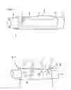 Fig. 02 - Bowel Implant