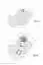 Fig. 04 - Ankle prosthesis for the arthrodesis of the calcaneum