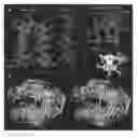 Fig. 01 - Computer comprising three-dimensional coordinates of a yeast RNA polymerase II