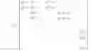 Fig. 02 - Decoder for low-density parity-check convolutional codes