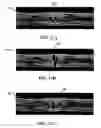 Fig. 12 - Porosity reference standard utilizing one or more hollow, non-cylindrical shafts