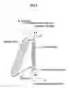 Fig. 02 - Radiator-Shroud Structure