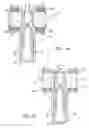 Fig. 05 - High performance overhead valvetrain assembly
