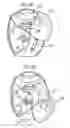 Fig. 04 - Medicament dispenser