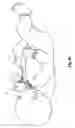 Fig. 08 - Supplemental air diffusion devices, kits and methods