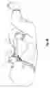 Fig. 09 - Supplemental air diffusion devices, kits and methods
