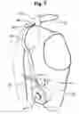 Fig. 06 - APPARATUS FOR HYPOXIC TRAINING AND THERAPY