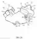 Fig. 13 - Nasal interface