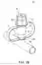 Fig. 07 - Combination tethered protective-cap and pressure cap