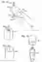 Fig. 14 - Variable stiffness flow control valve