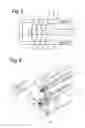 Fig. 04 - Roller Shutter