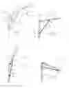 Fig. 02 - Foldable portable hoist system