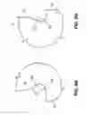 Fig. 06 - Yoke for a railway draft gear and method of making