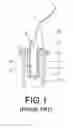 Fig. 02 - Bottle stopper for sealing bottle mouth tightly