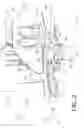 Fig. 04 - Engine mounting structure for an aircraft