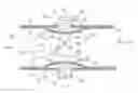 Fig. 01 - Engine mounting structure for an aircraft