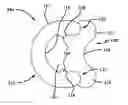 Fig. 01 - Multi-piece seal